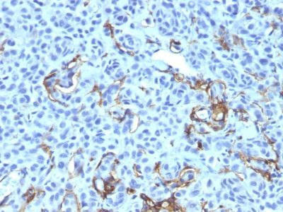 NGF Receptor Monoclonal Mouse Antibody (NGFR5 + NTR/912)