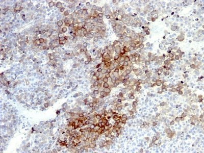 NGF Receptor Monoclonal Mouse Antibody (NGFR5 + NTR/912)