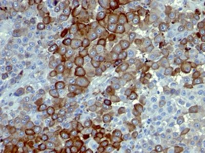 NGF Receptor Monoclonal Mouse Antibody (NTR/912)