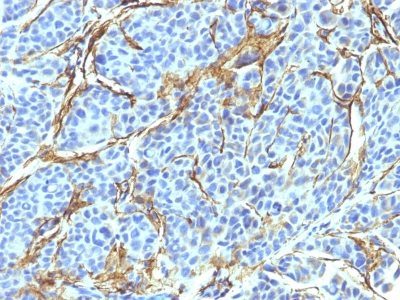 NGF Receptor Monoclonal Mouse Antibody (NTR/912)