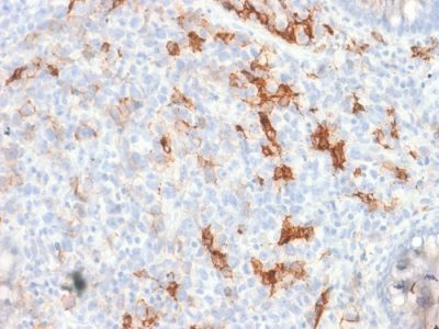 NGF Receptor Recombinant Monoclonal Rabbit Antibody (NGFR/1997R)