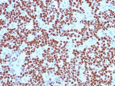 NKX2.2 Monoclonal Mouse Antibody (NX2/294)
