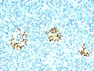 NKX2.2 Monoclonal Mouse Antibody (NX2/294)