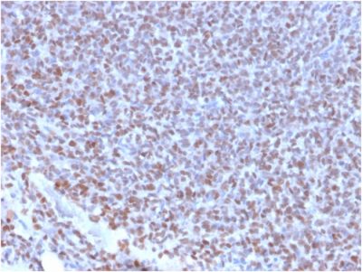 NKX2.2 Monoclonal Rabbit Antibody (NX2/2198R)
