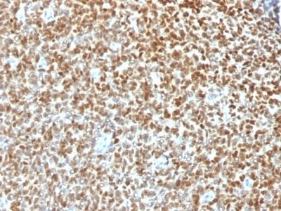 NKX2.2 Recombinant Monoclonal Rabbit Antibody (NX2/1422R)