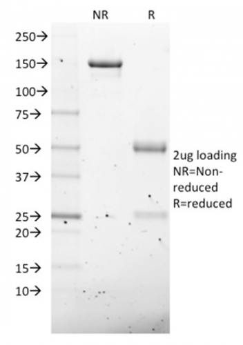 NKX2.8 Monoclonal Mouse Antibody (NKX28/2547)
