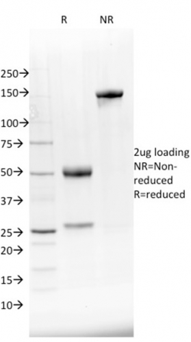 NKX2.8 Monoclonal Mouse Antibody (NKX28/2548)