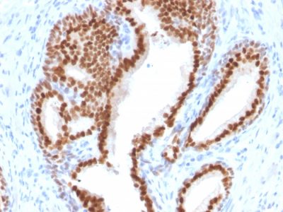NKX3.1 Monoclonal Mouse Antibody (NKX3.1/2576)