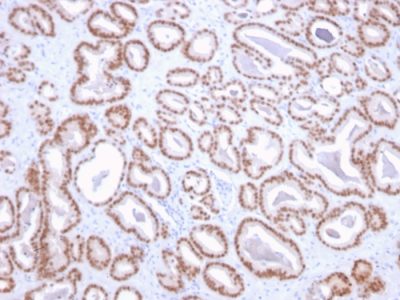 NKX3.1 Monoclonal Mouse Antibody (NKX3.1/2836)