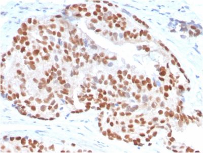 NKX3.1 Monoclonal Mouse Antibody (NKX3.1/3347)