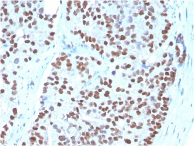 NKX3.1 Monoclonal Mouse Antibody (NKX3.1/3348)