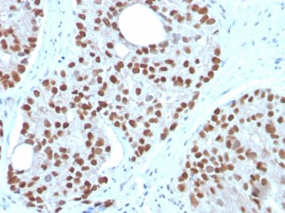 NKX3.1 Monoclonal Mouse Antibody (NKX3.1/3350)