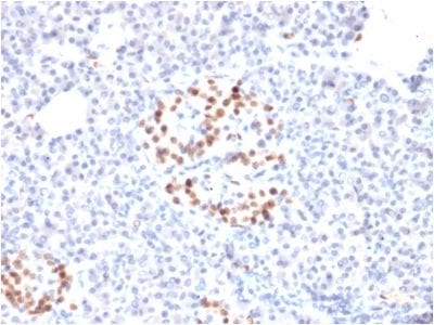 NKX6.1 Monoclonal Mouse Antibody (NKX61/2561)