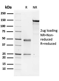 NME1 / nm23-H1 / NDPK-A Monoclonal Mouse Antibody (CPTC-NME1-2)