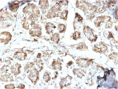 NME2 / nm23-H2 / NDPK-B Monoclonal Mouse Antibody (CPTC-NME2-2)