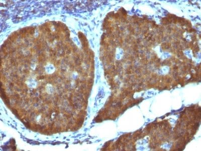 NSE-Gamma Monoclonal Mouse Antibody (ENO2/1462)