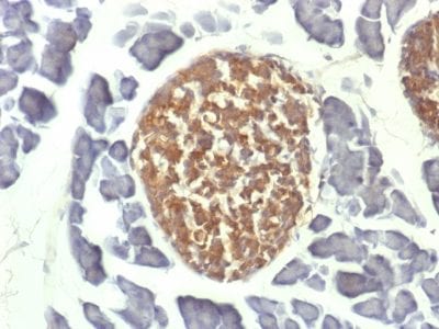 NSE-Gamma Monoclonal Mouse Antibody (ENO2/1462)