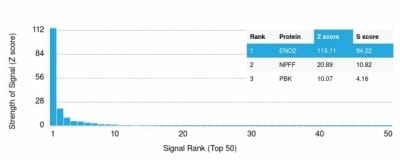 NSE-Gamma Monoclonal Mouse Antibody (ENO2/1462)