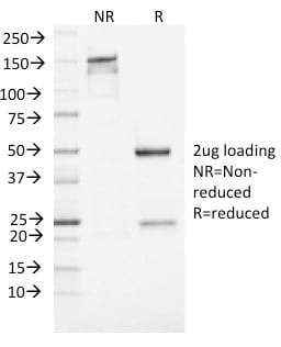 NSE-Gamma Monoclonal Mouse Antibody (ENO2/1462)