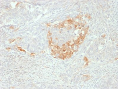 NSE-Gamma Monoclonal Mouse Antibody (NSE-P2)