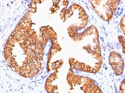Ornithine Decarboxylase 1 Monoclonal Mouse Antibody (ODC1/485)