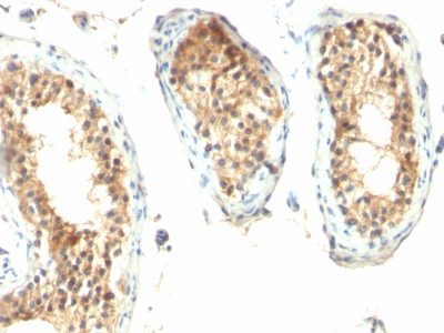 Ornithine Decarboxylase 1 Monoclonal Mouse Antibody (ODC1/485)