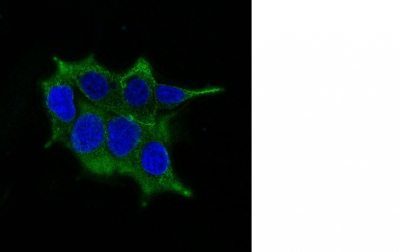 Ornithine Decarboxylase 1 Monoclonal Mouse Antibody (ODC1/485)