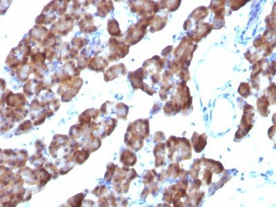 Ornithine Decarboxylase 1 Monoclonal Mouse Antibody (ODC1/485)