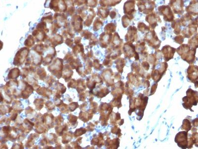 Ornithine Decarboxylase 1 Monoclonal Mouse Antibody (ODC1/486)