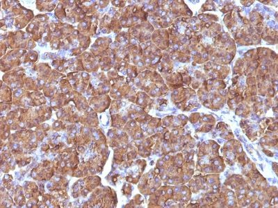 Ornithine Decarboxylase 1 Monoclonal Mouse Antibody (ODC1/486)