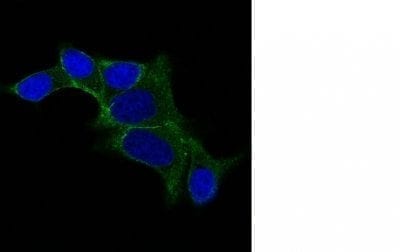 Ornithine Decarboxylase 1 Monoclonal Mouse Antibody (ODC1/487)