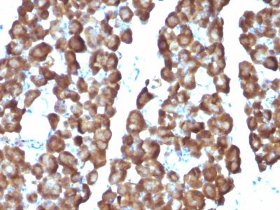 Ornithine Decarboxylase 1 Monoclonal Mouse Antibody (ODC1/487)