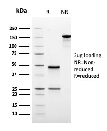 Ornithine Decarboxylase-1 Recombinant Monoclonal Mouse Antibody (rODC1/485)