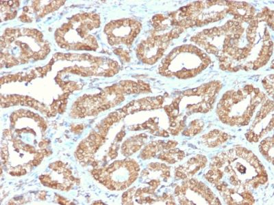 Ornithine Decarboxylase-1 Recombinant Monoclonal Rabbit Antibody (ODC1/2878R)
