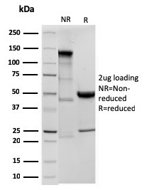 Ornithine Decarboxylase-1 Recombinant Monoclonal Rabbit Antibody (ODC1/3636R)