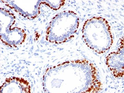 p40 Polyclonal Rabbit Antibody (PAb)