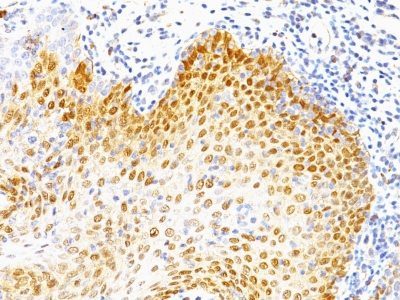 p53 Tumor Suppressor Monoclonal Mouse Antibody (Bp53-12 + DO-7)