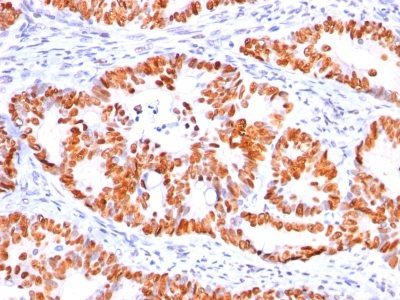 p53 Tumor Suppressor Monoclonal Mouse Antibody (Bp53-12)