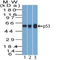 p53 Tumor Suppressor Monoclonal Mouse Antibody (Bp53-12)