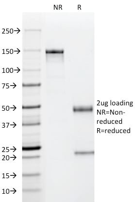 p53 Tumor Suppressor Monoclonal Mouse Antibody (PAb122)
