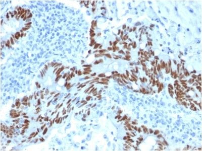 p53 Tumor Suppressor Monoclonal Mouse Antibody (PCRP-TP53-1F7)