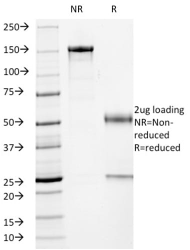 p53 Tumor Suppressor Monoclonal Mouse Antibody (PCRP-TP53-1F7)