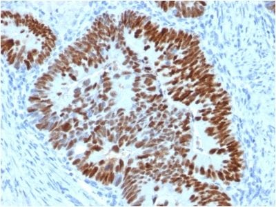 p53 Tumor Suppressor Monoclonal Mouse Antibody (PCRP-TP53-2A10)