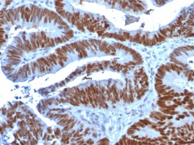 p53 Tumor Suppressor Monoclonal Mouse Antibody (TP53/1739)