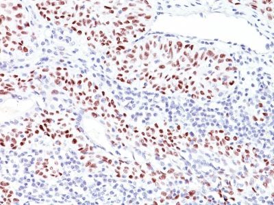 p53 Tumor Suppressor Monoclonal Mouse Antibody (TRP/816)