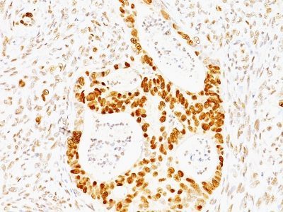 p53 Tumor Suppressor Monoclonal Mouse Antibody (TRP/817)