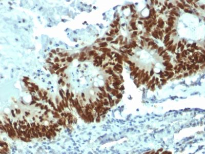 p53 Tumor Suppressor Protein Monoclonal Mouse Antibody (DO-1)