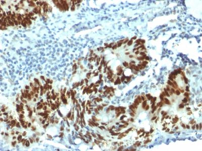 p53 Tumor Suppressor Protein Monoclonal Mouse Antibody (PAb1801)