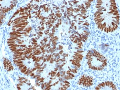 p53 Tumor Suppressor Protein Polyclonal Rabbit Antibody (N/A)