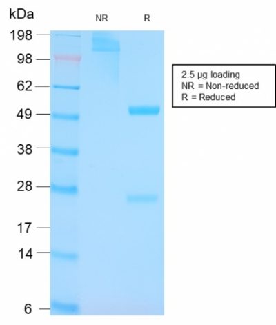 p53 Tumor Suppressor Protein Recombinant Monoclonal Rabbit Antibody (TP53/3156R)